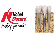 nobel-biocare-implants-maredent-dental-clinic-europe-croatia nobel-biocare-implants-maredent-dental-clinic-europe-croatia