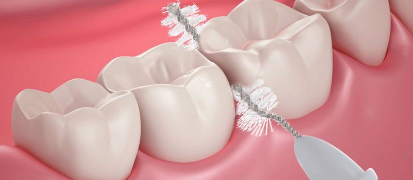 Slikovni rezultat za zubni konac ili interdentalna četkica